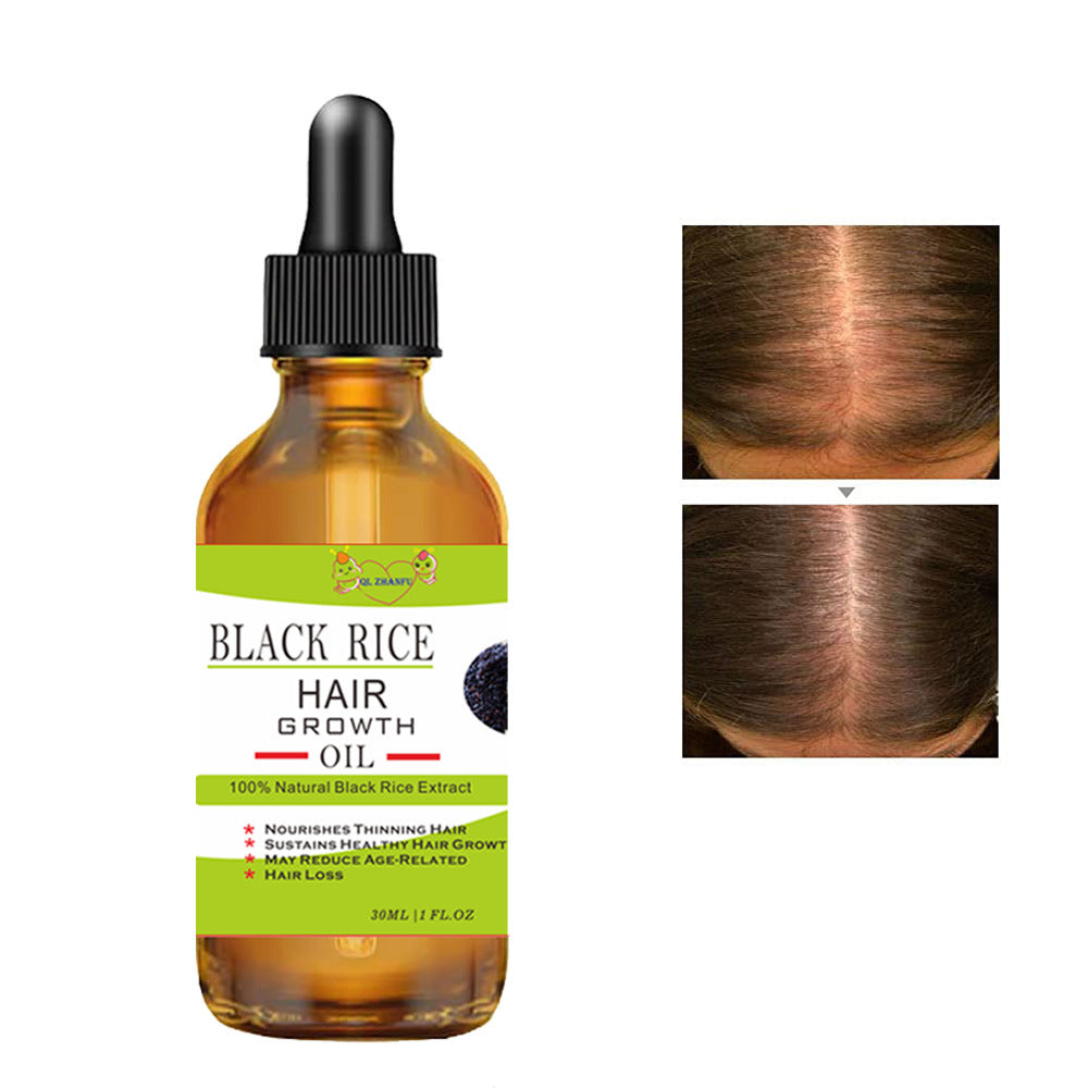 Black Rice Hair Growth oil